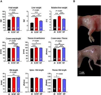 Mitochondrial DNA Depletion in Granulosa Cell Derived Nuclear Transfer Tissues